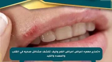 «تحذير مهم» أعراض أمراض الفم وكيف تكشف مشاكل صحية في القلب والمعدة والكبد